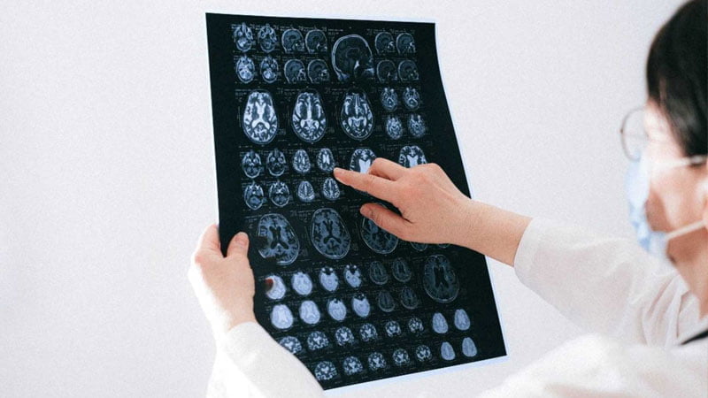 Red Light Therapy Cognitive Proficiency